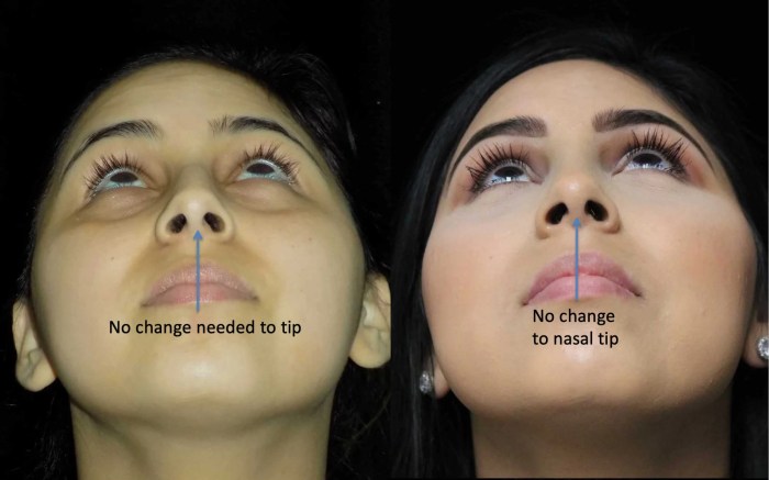 Nose job stick of truth