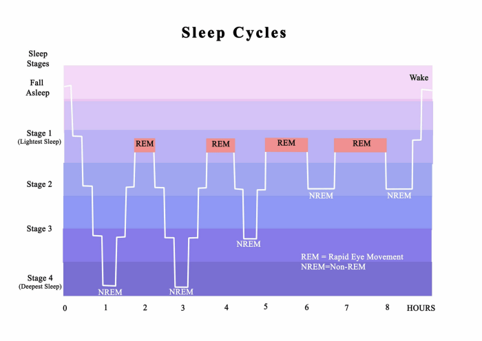 Eyes open sleep sleeping happens if lagophthalmos nocturnal term medical