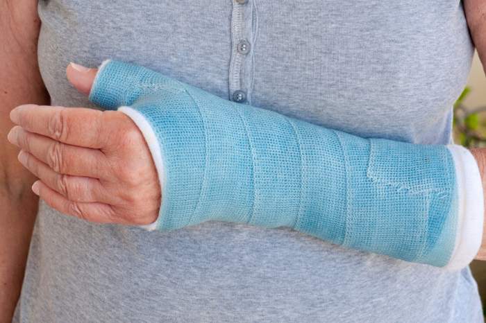 Cast casts waterproof care do don moisture adversely affected even bandage ts